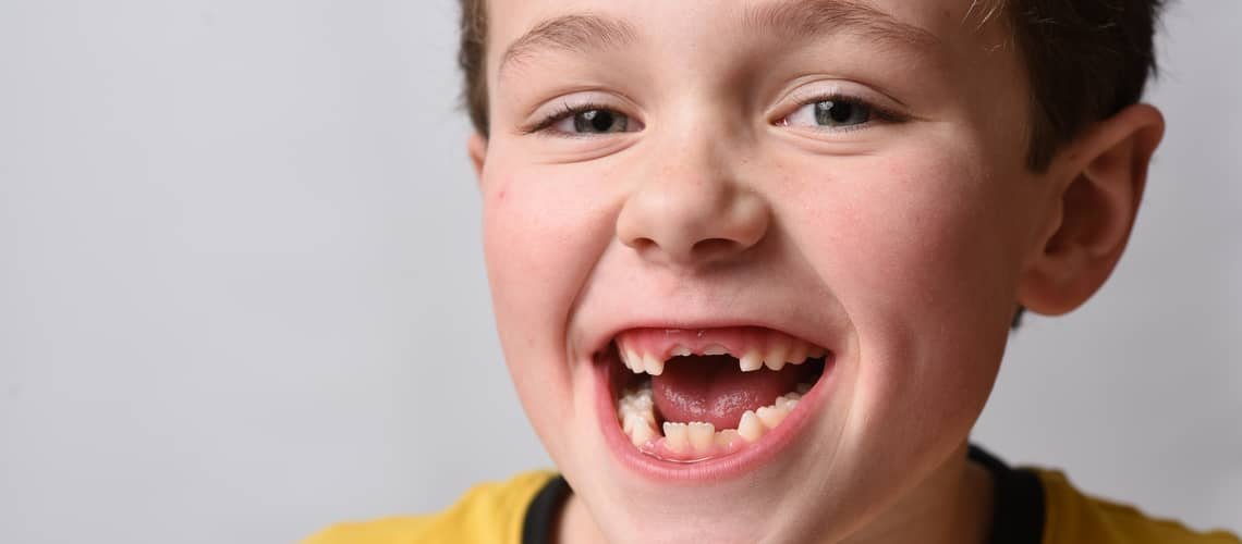 Kdy vypadají mléčné zuby?