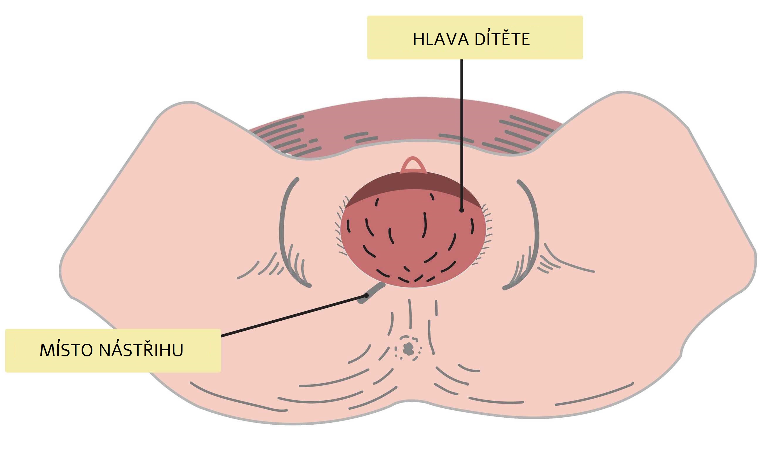 Jak vypadá nástřih hráze obrázek