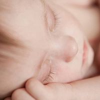 Příznaky Downova syndromu u novorozence