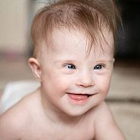 Novorozenec s Downovým syndromem